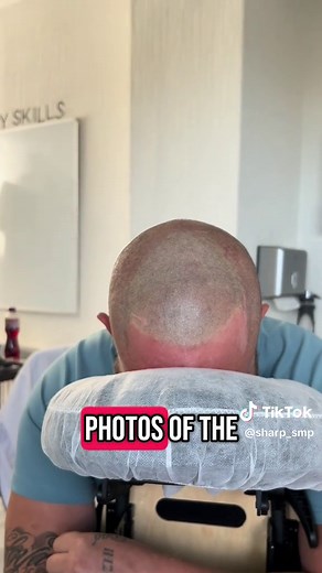 Understanding SMP Cost: Get Your Free Quote