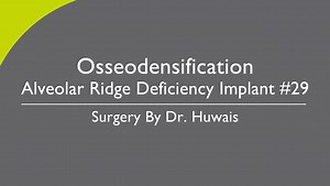 Osseodensification Alveolar Ridge Deficiency Implant #29 Surgery By Dr. Huwais