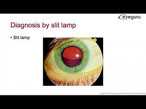 1.7: Lens Dislocations