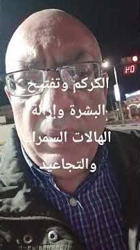 الكركم وإذالة الهالات السوداء والتجاعيد
