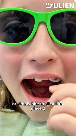 What is Invisalign Palatal Expander (IPE)?