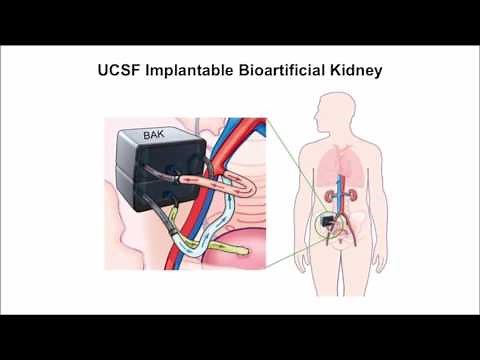 Developing an artificial kidney: Part 3 with Dr. Morteza Ahmadi