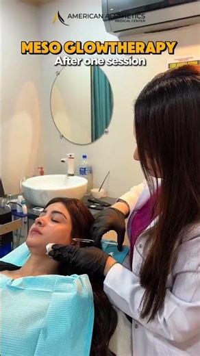 How Mesotherapy Revives Dull Skin Without Surgery