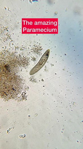 THE AMAZING PARAMECIUM #fyp #biology #biologist #biologia #drbioforever #microscopy #paramecium