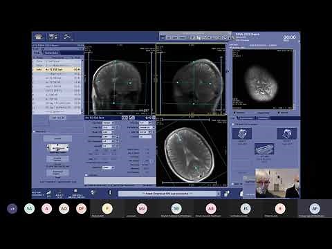 Demo on Optimizing Productivity with HyperSpeed Neuro Protocols on SIGNA™ Pioneer