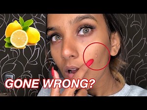 I Applied Lemon On My Face For A Week & Here's What Happened