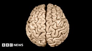 The strange afterlife of Einstein's brain