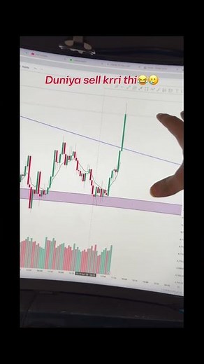 Never Give Up in Forex Trading 💹 | Success Mindset #Shorts