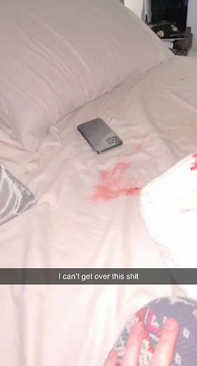 Dealing with a Cheetos Mishap: What Happens When Your Friend Throws Up Flaming Hot Cheetos in Your Bed