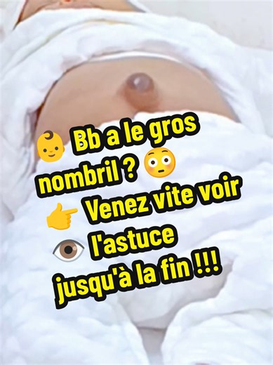 ⚠️ Important : cette démonstration est présentée à titre informatif. Elle ne doit être réalisée qu'après consultation et recommandation d'un professionnel de santé. Tous les gros nombrils ne nécessitent pas la même prise en charge. 👶 Bébé a le gros nombril ? Dans cette vidéo, nous vous montrons une méthode traditionnellement utilisée par de nombreuses familles. La pièce doit être bien emballée dans une compresse pour éviter tout contact direct avec la peau. ⚠️ Le pansement doit être renouvelé c