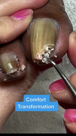 Elderly Pedicure: Gentle Foot Care Techniques