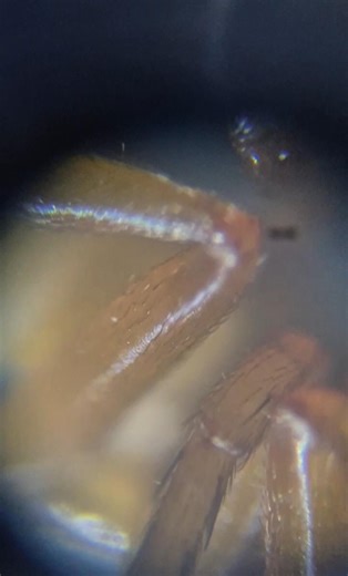 Spider's under a microscope (Örümceğin mikroskop altındaki görünümü)#microscope #explore #science