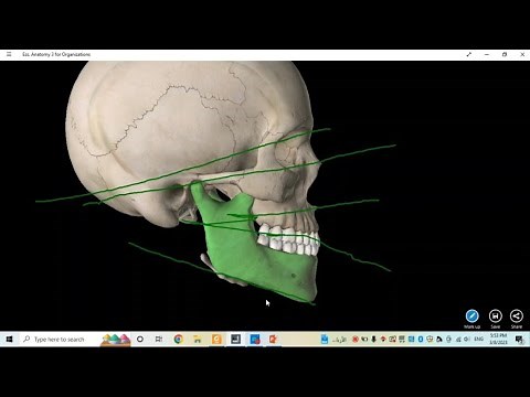 lateral cephalometric x-ray analysis(عربي)