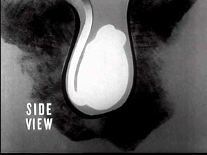 Your Body During Adolescence (1955)