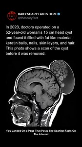 188K views · 194 reactions | In 2023, doctors operated on a...