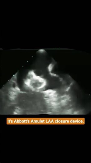 It's Abbott's Amulet LAA closure device.