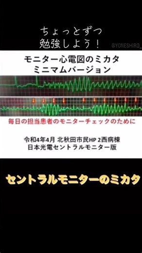 【循環器病棟 基本のキ】 モニターのミカタ 記録前のルーチンチェック
