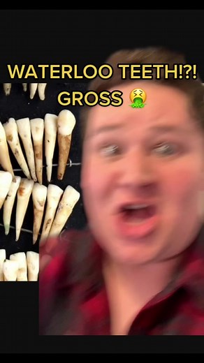 Waterloo Teeth: A Creepy History