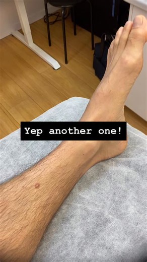 Are you a health professional and want to learn dermoscopy? 🔍 I recommend the certificate dermoscopy courses by @healthcert Use discount code DRJOHN for a 15% discount. Are you from the U.S. 🇺🇸 and want to learn the basics of skin cancer medicine and how to introduce it into your practice? I recommend the Skin Cancer Medicine Accelerator Program by MoleScan. Use discount code DRJOHNUS See links in bio for more information. #dermoscopy #skincancer #skincancerdoctor #buderim #sunshinecoast #mel