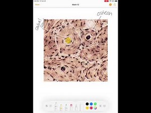 Microscopic Structure of Compact Bone Video