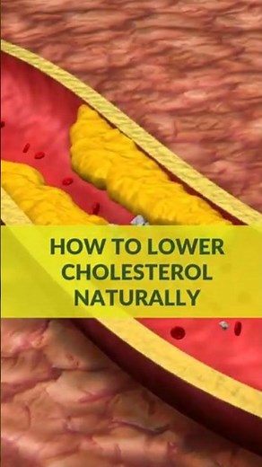 How to Lower Cholesterol Naturally