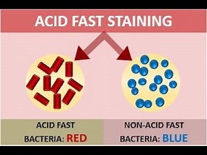 Acid Fast stains for Mycobacteria ; Zhiel Neelsen, Kinyoun, Auramine Rhodamine Stains
