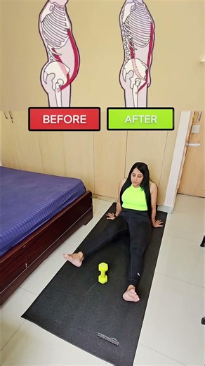 Fix Your Anterior Pelvic Tilt in Just Minutes a Day! 🔥