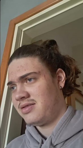 hungary and romania kissing