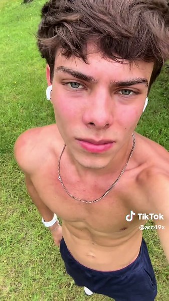 Natural Acne Solutions: Clear Skin With Raw Honey