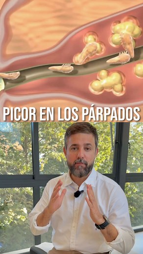 Dr. Jorge Peraza - Miopía, Hipermetropía, Astigmatismo | ¿Sabías que existen diferentes tipos de blefaritis? 👁️ La blefaritis es una inflamación del borde de los párpados que puede causar... | Instagram