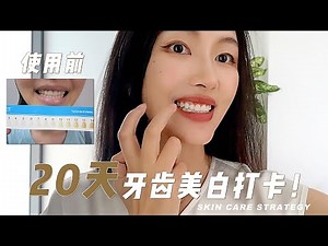 Polanight 21天牙齿美白实测：有效！牙白了真的会更爱笑诶！
