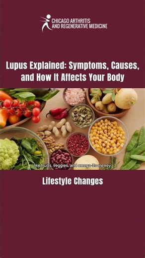 Lifestyle changes | Lupus Explained Symptoms, and Causes #Rheumatology