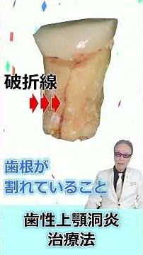 耳鼻科だけでは治らない蓄膿症は歯が原因の時も、歯性上顎洞炎 #shorts