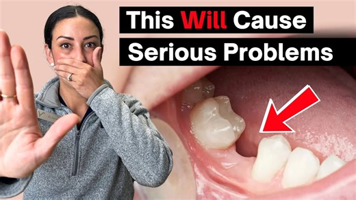 3.9K views · 17 reactions | Dentists asking you to replace a tooth fast is NOT a scam. Here's why... - - - - - - - How Much Do Dental Implants Cost?? Find out NOW: https://bit.ly/4gvWCJc 60-Second Eligibility Quiz: https://bit.ly/4mjMdlb | Nuvia Dental Implant Center | Facebook