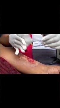 Basic First Aid Procedure