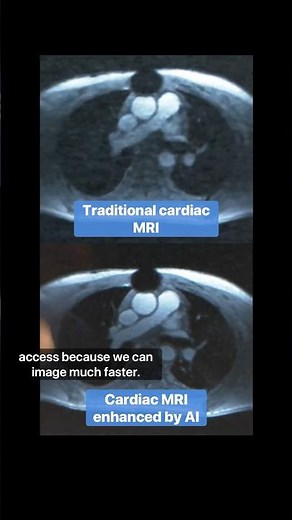How AI is Changing Medical Imaging