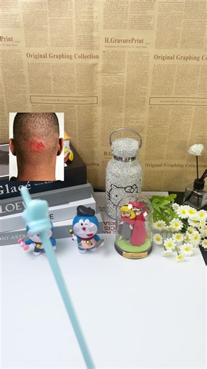 Understanding Dermatitis and Folliculitis