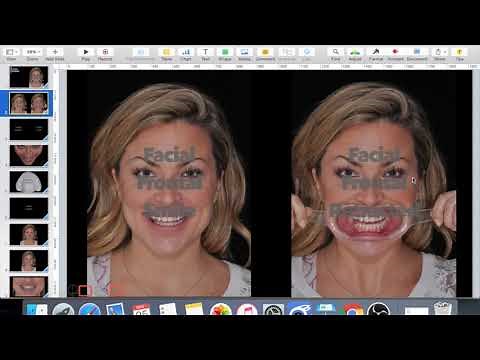 DSD Keynote Tutorial By Dr Nour Marshaha