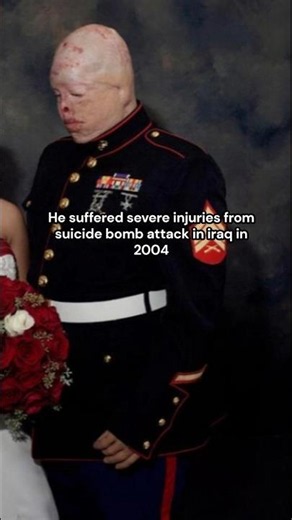 Story of Marine Sergeant Tyler Ziegel #militaryveteran #iraqwar #ptsdawareness #history
