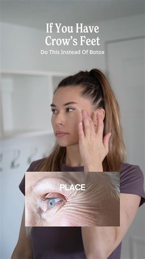Get rid of crows feet naturally without Botox