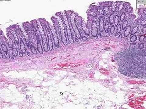 Histología de colon