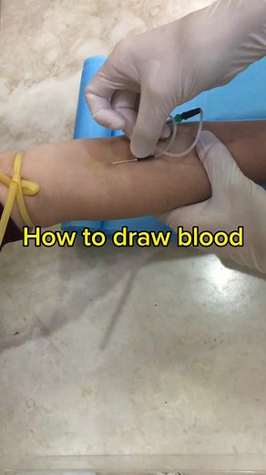 How to draw blood#drawblood #phlebotomist #phlebotomy #venepuncture #抽血 #血液検査 #採血 #technology #education #butterflyneedle #fyp