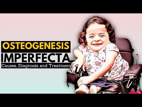 OSTEOGENESIS IMPERFECTA (OI), Causes, Signs and Symptoms, Diagnosis and Treatment.