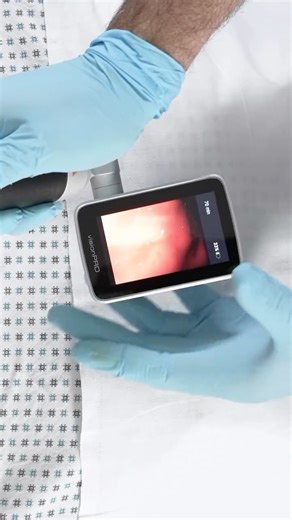 HEINE OPTOTECHNIK | Ready to take your airway management skills to the next level? The 5-part video series on intubation with a video laryngoscope by Dr Jim... | Instagram