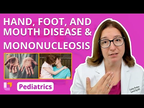 Hand Foot Mouth & Mononucleosis: Alterations in Health - Pediatric Nursing | ‪@LevelUpRN‬