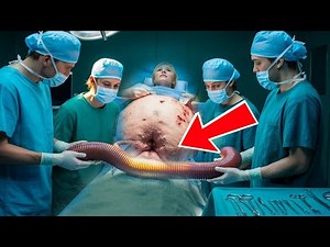 Doctors Were Shocked When They Saw a Woman With Something Coming Out of Her Stomach...