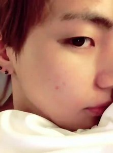 2.6K views · 459 reactions | 150710-V TWITTER UPDATE 더이상혼자가아니야 Trans: You're not alone anymore This pimple made a new friend. | BTS V - FACTS ツ | Facebook