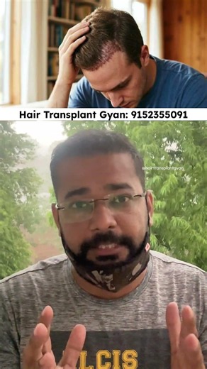 When to start Gym After Hair Transplant ?