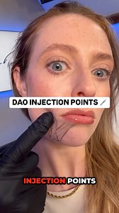 12K views · 106 reactions | When treating the DAO, I often choose...