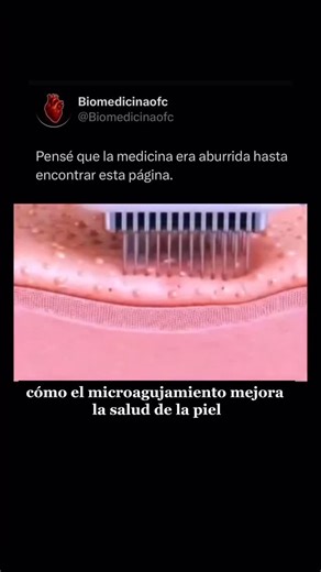 @biomedicinaofc | El Dermapén es un dispositivo de microagujamiento que estimula la renovación natural de la piel de forma controlada y segura. Sus... | Instagram